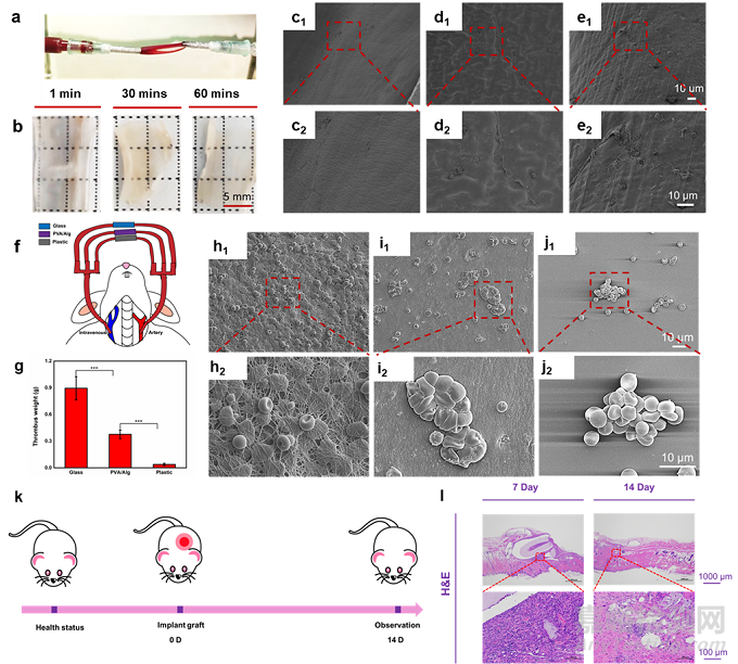 同軸打印小直徑人工血管方面取得重要進(jìn)展