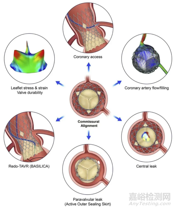 2022年結(jié)構(gòu)性心臟病醫(yī)療器械年度盤點(diǎn)