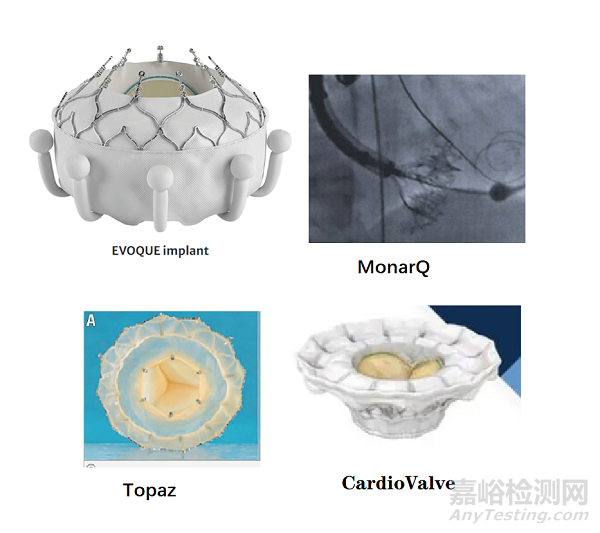 2022年結(jié)構(gòu)性心臟病醫(yī)療器械年度盤點(diǎn)