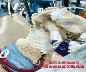 國(guó)產(chǎn)高性能ECMO，實(shí)現(xiàn)重大突破