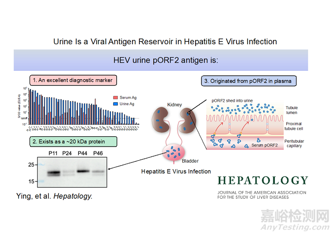 尿液測肝炎最新研究