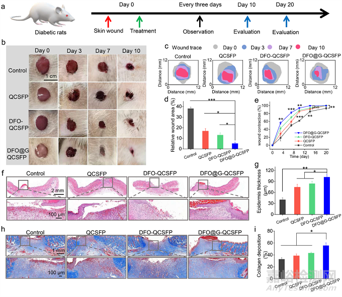 具有促進血管生成的糖尿病傷口微環(huán)境自適應(yīng)性水凝膠促進傷口愈合的研究