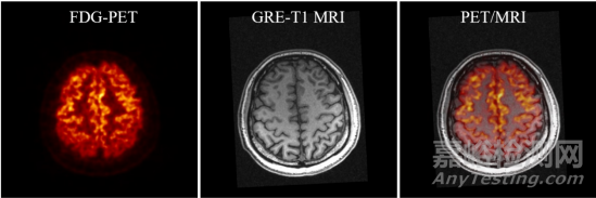 中科院先進(jìn)院發(fā)布首臺高清晰磁兼容腦PET功能成像儀器