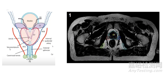 Elekta Unity放射治療系統(tǒng)通過FDA認(rèn)證