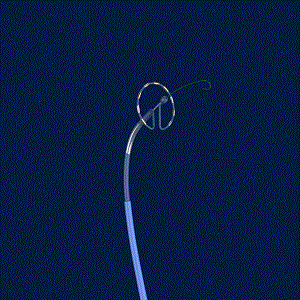 PulseSelect：IDE研究顯示療效超越預期