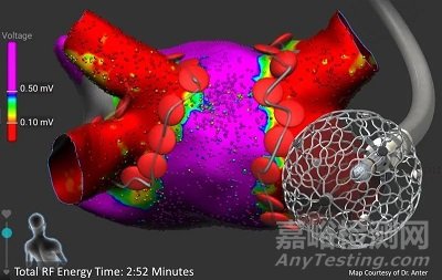 Affera:美敦力首款三維標(biāo)測(cè)和消融系統(tǒng)獲CE批準(zhǔn)