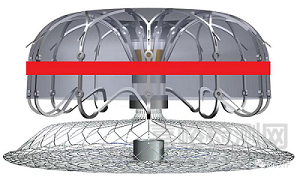 E-SeaLA：全球首創(chuàng)具有PFA消融功能的左心耳封堵器