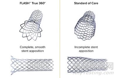 FLASH:冠脈開口病變的雙球囊技術(shù)