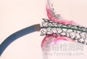 FLASH:冠脈開口病變的雙球囊技術(shù)