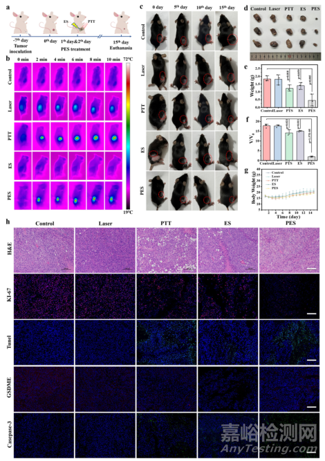 中科院開發(fā)可穿戴電刺激增強(qiáng)型光熱貼片用于黑色素瘤治療