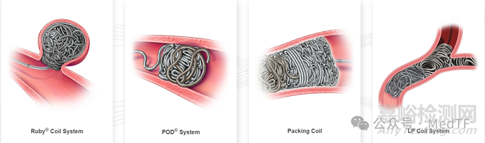 Ruby XL：全球最長、最粗、最柔軟的彈簧圈獲FDA批準(zhǔn)上市