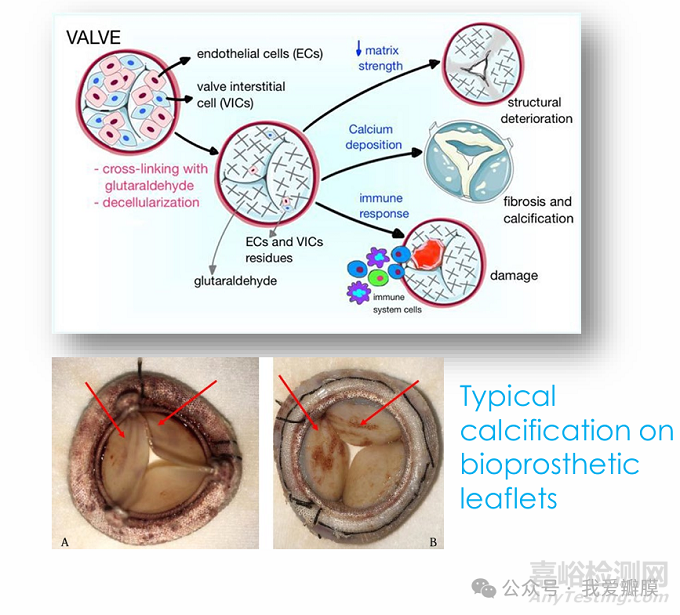 全球首個！Foldax Tria 聚合物二尖瓣獲印度 CDSCO 批準(zhǔn)，顛覆百年瓣膜治療格局