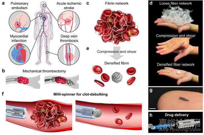 【創(chuàng)新醫(yī)械】Milli-Spinner:能將血栓體積縮小95%取栓神器,首過再通率超90%