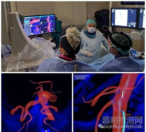 因涂層脫落風(fēng)險(xiǎn)，Centerline血管導(dǎo)航導(dǎo)絲一級召回