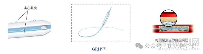 血管介入特殊球囊技術(shù)解析