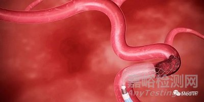 ANA5：新一代漏斗狀取栓導(dǎo)管獲CE批準(zhǔn)上市