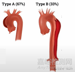 【創(chuàng)新醫(yī)械】AX-GEN01：生物可吸收主動脈夾層修補補片，實現(xiàn)血管壁再生