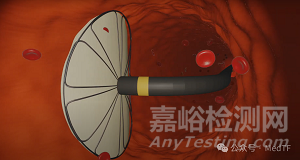 【創(chuàng)新醫(yī)械】AX-GEN01：生物可吸收主動脈夾層修補補片，實現(xiàn)血管壁再生