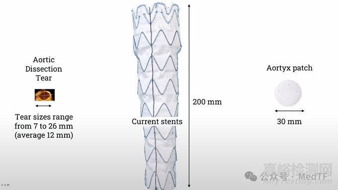 【創(chuàng)新醫(yī)械】AX-GEN01：生物可吸收主動脈夾層修補補片，實現(xiàn)血管壁再生