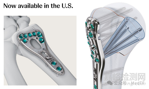VOLT:強(qiáng)生推出全新的骨折內(nèi)固定系統(tǒng)