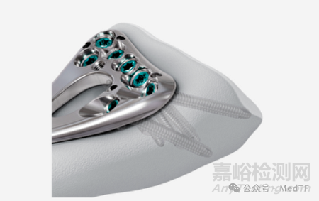 VOLT:強(qiáng)生推出全新的骨折內(nèi)固定系統(tǒng)