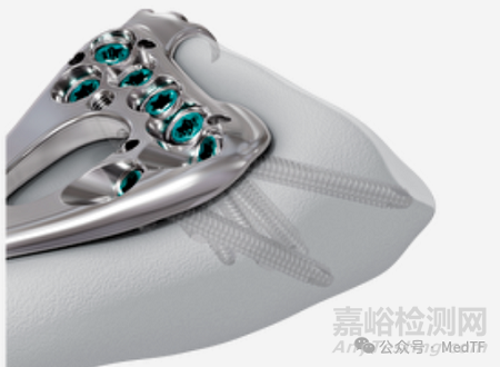 VOLT:強(qiáng)生推出全新的骨折內(nèi)固定系統(tǒng)