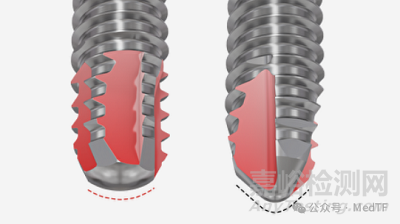 VOLT:強(qiáng)生推出全新的骨折內(nèi)固定系統(tǒng)