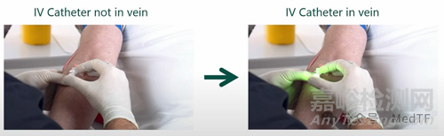 【創(chuàng)新醫(yī)械】Cannulight :將靜脈穿刺成功率提高60%的LED燈