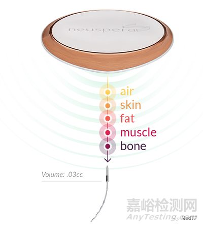 【創(chuàng)新醫(yī)械】Neuspera：首款微型骶骨神經刺激器獲批FDA，打破美敦力、波科在急迫性尿失禁壟斷