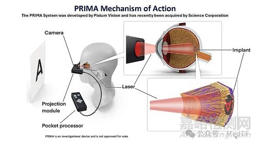 【創(chuàng)新醫(yī)械】Prima:恢復(fù)失明者視力的腦機(jī)接口