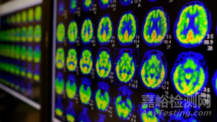 GE醫(yī)療PET顯像劑，獲批阿爾茨海默病診斷適應(yīng)癥