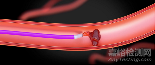 360°外周抽吸導(dǎo)管獲批上市