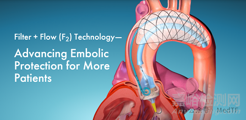 【創(chuàng)新醫(yī)械】Filter + Flow (F2):包含自膨脹式圓柱形鎳鈦合金支架和靜電紡絲過濾膜的腦保護(hù)器