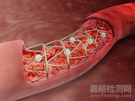 【創(chuàng)新醫(yī)械】可吸收纖顫支架治療下肢缺血
