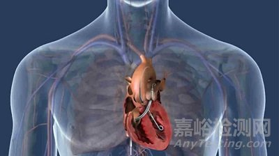 介入式人工心臟技術(shù)、產(chǎn)品與市場(chǎng)分析