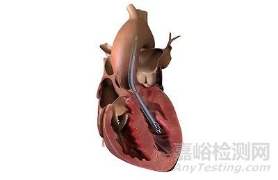 介入式人工心臟技術(shù)、產(chǎn)品與市場(chǎng)分析