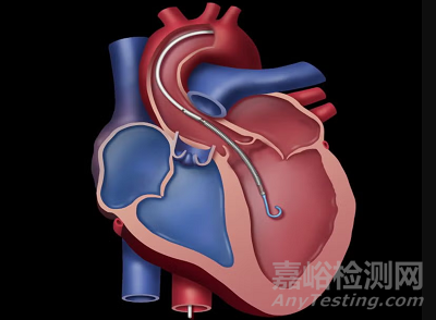 企業(yè)名稱	已知產(chǎn)品/項(xiàng)目名稱	技術(shù)路線	備注 核心醫(yī)療	CorVad?	電機(jī)內(nèi)置	在LVAD領(lǐng)域有積累，采用軸向磁通多驅(qū)技術(shù) 心擎醫(yī)療	NyokAssist?	電機(jī)外置	可折疊葉輪，小介入尺寸，覆蓋急重癥體外生命支持場(chǎng)景 心嶺邁德	在研	未公開	研發(fā)中 迪遠(yuǎn)醫(yī)療/晟視科技	在研	未公開	研發(fā)中 豐凱利醫(yī)療	SynFlow?3.0	電機(jī)外置	驅(qū)動(dòng)電機(jī)可重復(fù)使用，已進(jìn)入NMPA創(chuàng)新醫(yī)療器械特別審查程序 生命盾醫(yī)療	pVAD (未公布具體名稱)	電機(jī)內(nèi)置	微型高速葉輪，無灌封電機(jī)密封技術(shù) 煥擎醫(yī)療	微型介入式人工心臟	電機(jī)內(nèi)置	組脈醫(yī)療孵化 通靈仿生	微型心臟導(dǎo)管泵	電機(jī)內(nèi)置	突破微電機(jī)、抗凝降溫、低溶血葉輪等技術(shù) 心恒睿醫(yī)療	在研	電機(jī)內(nèi)置	高效流體設(shè)計(jì)，流量達(dá)4.0L/min以上，微型植入電機(jī)可持續(xù)穩(wěn)定運(yùn)轉(zhuǎn)7天以上 說明：