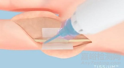 全球首個免縫合周圍神經(jīng)修復(fù)平臺獲批FDA