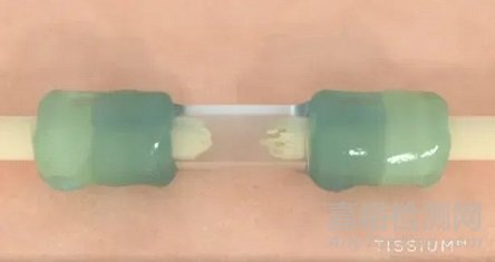 全球首個免縫合周圍神經(jīng)修復(fù)平臺獲批FDA