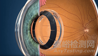 Ocumetics 可調(diào)節(jié)人工晶狀體啟動首次人體試驗 
