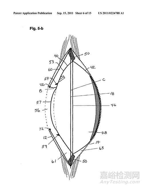 Ocumetics 可調(diào)節(jié)人工晶狀體啟動首次人體試驗 