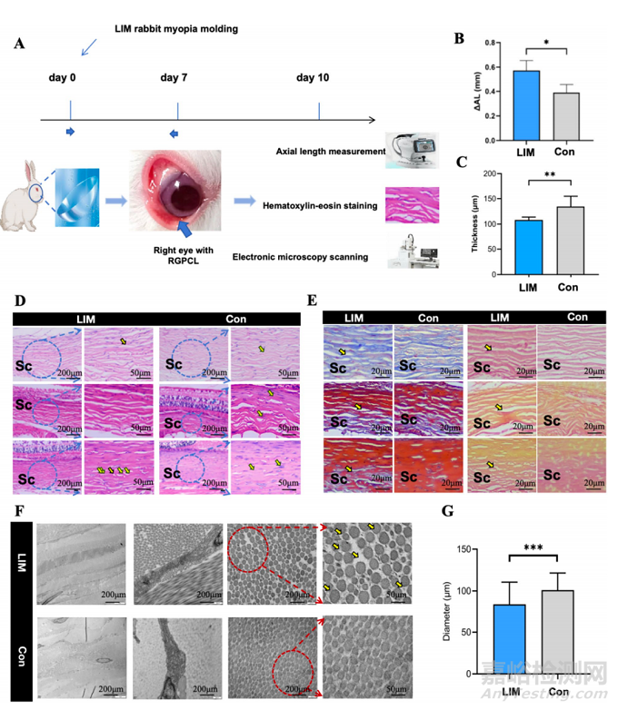 【創(chuàng)新醫(yī)械】新型自發(fā)電驅(qū)動鞏膜加固仿生壓電貼片突破高度近視治療