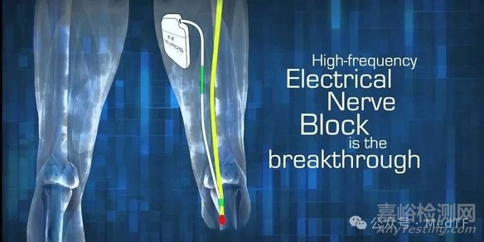Altius：治療慢性截肢后幻肢疼痛和殘肢疼痛的神經(jīng)刺激產(chǎn)品