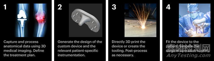 3D打印植入物時(shí)的設(shè)計(jì)與主要考慮因素