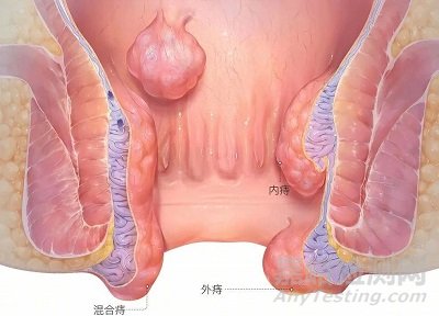 施愛德創(chuàng)新醫(yī)械一次性帶可吸收釘電動痔吻合器技術(shù)解析