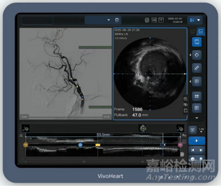 國產(chǎn)首款外周血管內(nèi)超聲導(dǎo)管獲批上市