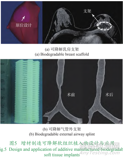 增材制造個(gè)性化植入物技術(shù)發(fā)展與挑戰(zhàn)