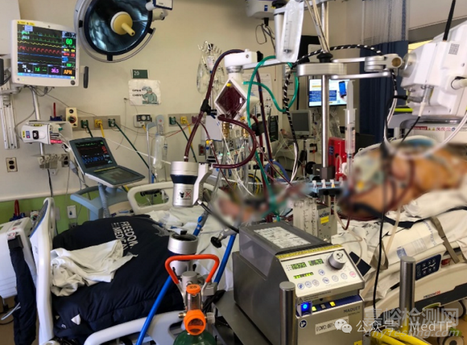 【創(chuàng)新醫(yī)械】CDX：僅8斤重的可穿戴ECMO