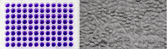 醫(yī)療器械細胞毒性試驗的特點及解決方案