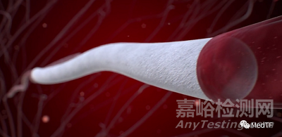 【創(chuàng)新醫(yī)械】XABG：用于冠狀動(dòng)脈搭橋手術(shù)的修復(fù)性人造血管